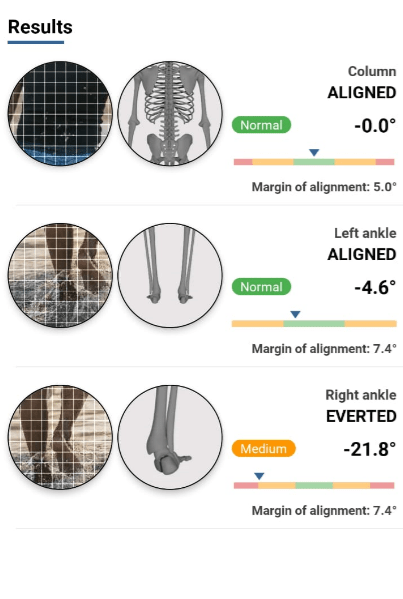 THE MOVEMENT ENCODER